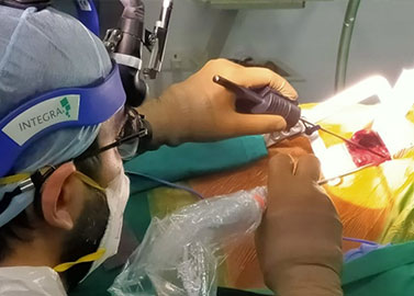 Dr-Manish-Hinduja-Best-Cardicac-Surgeon-Mumbai-Minimally-Invasive-Cardiac-Surgery