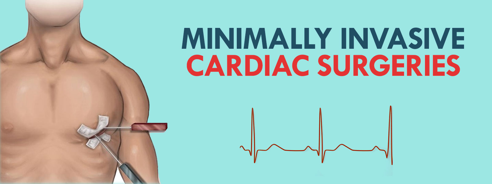 Dr-Manish-Hinduja-Best-Cardicac-Surgeon-Mumbai-Minimally-Invasive-Cardiac-Surgeries