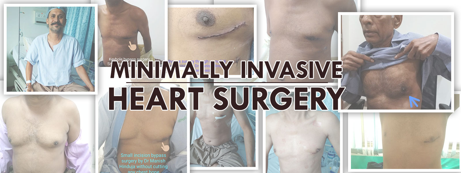 Dr-Manish-Hinduja-Best-Cardicac-Surgeon-Mumbai-Minimally-Invasive-Heart-Surgery-Banner
